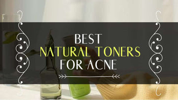 best-natural-toners-for-acne